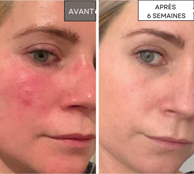 Omnilux Contour Face